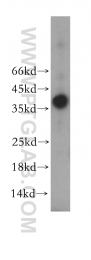 17171-1-AP - PSCA