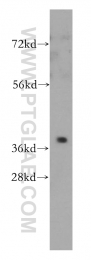 14164-1-AP - ZADH1