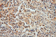15286-1-AP - PTPN7 / HEPTP