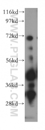 15286-1-AP - PTPN7 / HEPTP