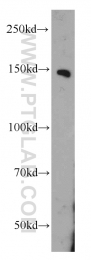 55123-1-AP - CD148 / PTPRJ