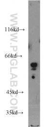 13035-1-AP - RAD9A