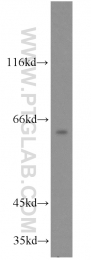 13035-1-AP - RAD9A