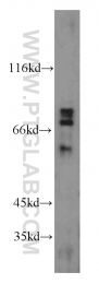 11825-1-AP - RAG2