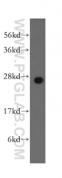 12340-1-AP - RALB