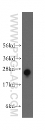 12340-1-AP - RALB