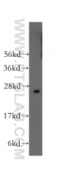 12340-1-AP - RALB