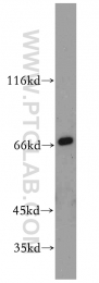 21107-1-AP - RANBP10