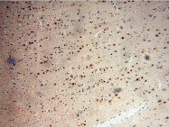 17875-1-AP - RANBP3L