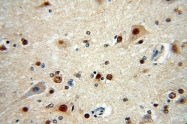 17875-1-AP - RANBP3L