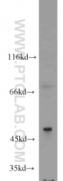 17875-1-AP - RANBP3L