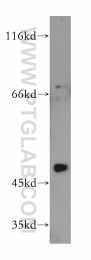 17875-1-AP - RANBP3L