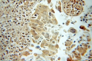 51038-1-AP - RanBP9 / Importin-9