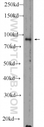 51038-1-AP - RanBP9 / Importin-9