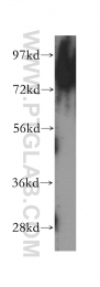 51038-1-AP - RanBP9 / Importin-9