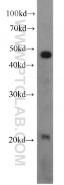10840-1-AP - RAP1B