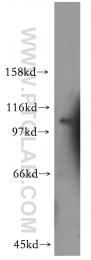 13882-1-AP - RAPGEF4