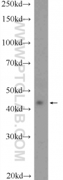 20453-1-AP - RAPSN / RNF205