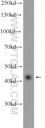 20453-1-AP - RAPSN / RNF205