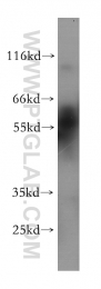60119-1-Ig - RAR-beta / RARB