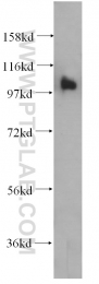 14150-1-AP - RASA3