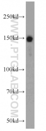 22140-1-AP - RASAL2 / NGAP