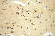 17121-1-AP - RASGEF1A