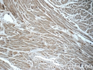 17971-1-AP - RASIP1 / RAIN
