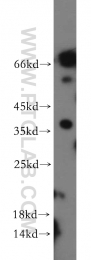 21219-1-AP - RASSF1