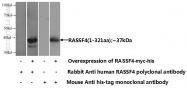19118-1-AP - RASSF4