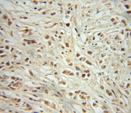 10048-2-Ig - Retinoblastoma-associated protein / RB1