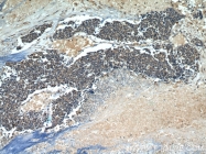 10048-2-Ig - Retinoblastoma-associated protein / RB1