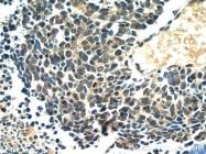 10048-2-Ig - Retinoblastoma-associated protein / RB1