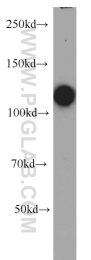 10048-2-Ig - Retinoblastoma-associated protein / RB1