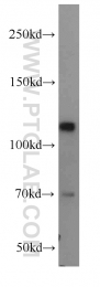 10048-2-Ig - Retinoblastoma-associated protein / RB1