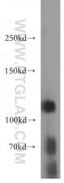 17218-1-AP - Retinoblastoma-associated protein / RB1