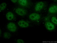25628-1-AP - Retinoblastoma-associated protein / RB1
