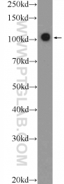 25628-1-AP - Retinoblastoma-associated protein / RB1