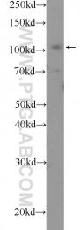 25628-1-AP - Retinoblastoma-associated protein / RB1
