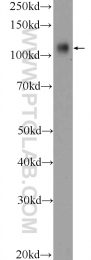 25628-1-AP - Retinoblastoma-associated protein / RB1