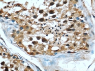 66060-1-Ig - RBBP4 / RBAP48