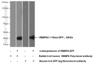 11882-1-AP - RBBP6 / RBQ1