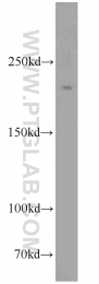 11882-1-AP - RBBP6 / RBQ1