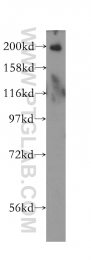 11882-1-AP - RBBP6 / RBQ1