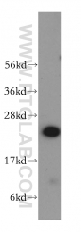 12230-2-AP - RBBP9 / BOG