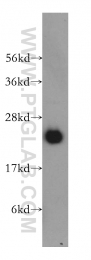 12230-2-AP - RBBP9 / BOG