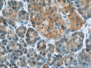 66015-2-Ig - RBBP9 / BOG