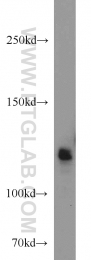 14423-1-AP - RBM10