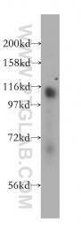 14423-1-AP - RBM10