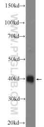 17220-1-AP - RBM11